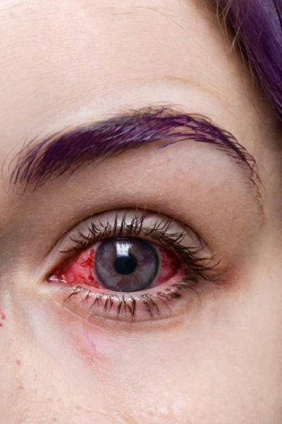 Perfect Eyes XL - V3_Bloodshot